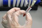 ذخیره‌سازی ۱۰۷ نمونه خون بند ناف در چهارمحال و بختیاری