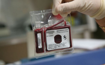 افزایش ۷۰ درصدی ذخیره‌سازی نمونه خون بند ناف نوزاد در چهارمحال و بختیاری