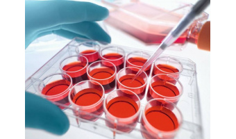 افزایش ۱۲۶ درصدی ذخیره خون بند ناف در چهارمحال و بختیاری