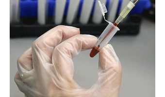 ذخیره‌سازی ۱۰۷ نمونه خون بند ناف در چهارمحال و بختیاری